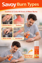 Savoy Burn Relief Spray 50ml | Fast Cooling Antiseptic Spray for Minor Burns, Scalds & Sunburn Relief