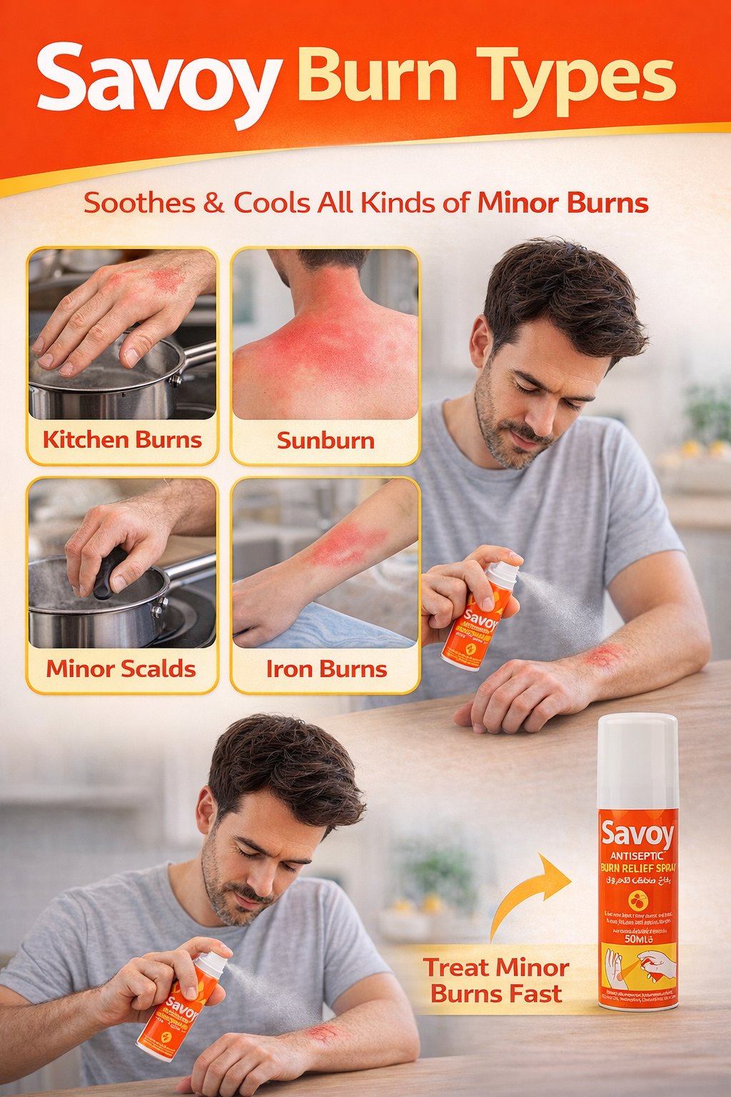 Savoy Burn Relief Spray 50ml | Fast Cooling Antiseptic Spray for Minor Burns, Scalds & Sunburn Relief